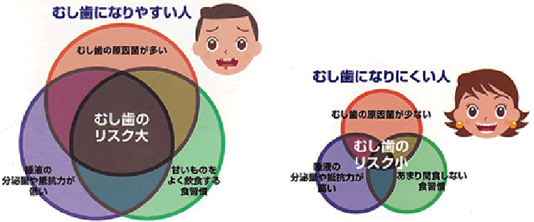 虫歯の原因菌が多い、唾液の分泌量や抵抗力が低い、甘いものをよく飲食する食習慣、以上が重なると虫歯のリスクが大きくなります。