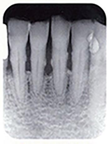 X線写真検査の撮影写真